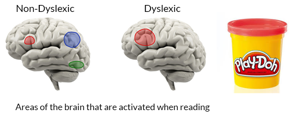 Brains are Like Play-Doh: The Reading Approach that Changes the Dyslexic Brain